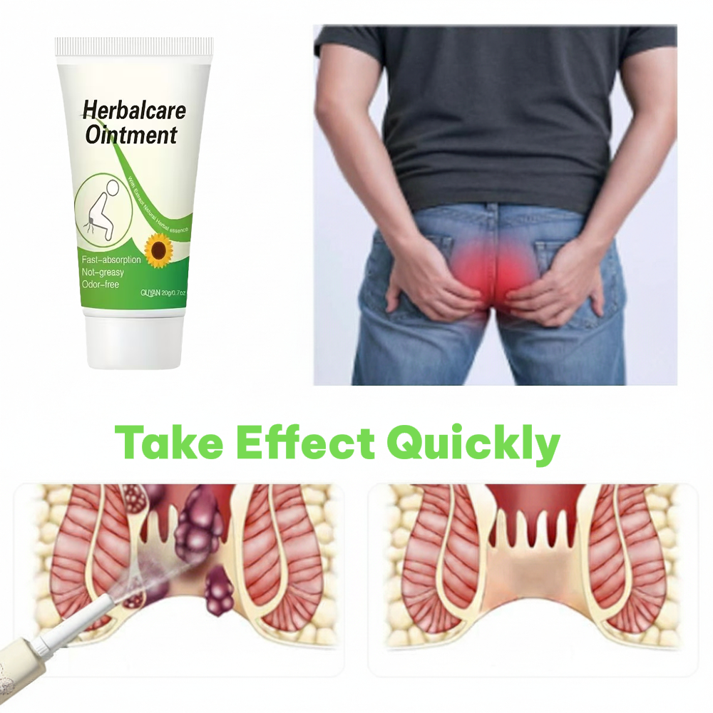 Hemorrhoid Removal Ointment